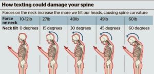 How texting could damage your spine